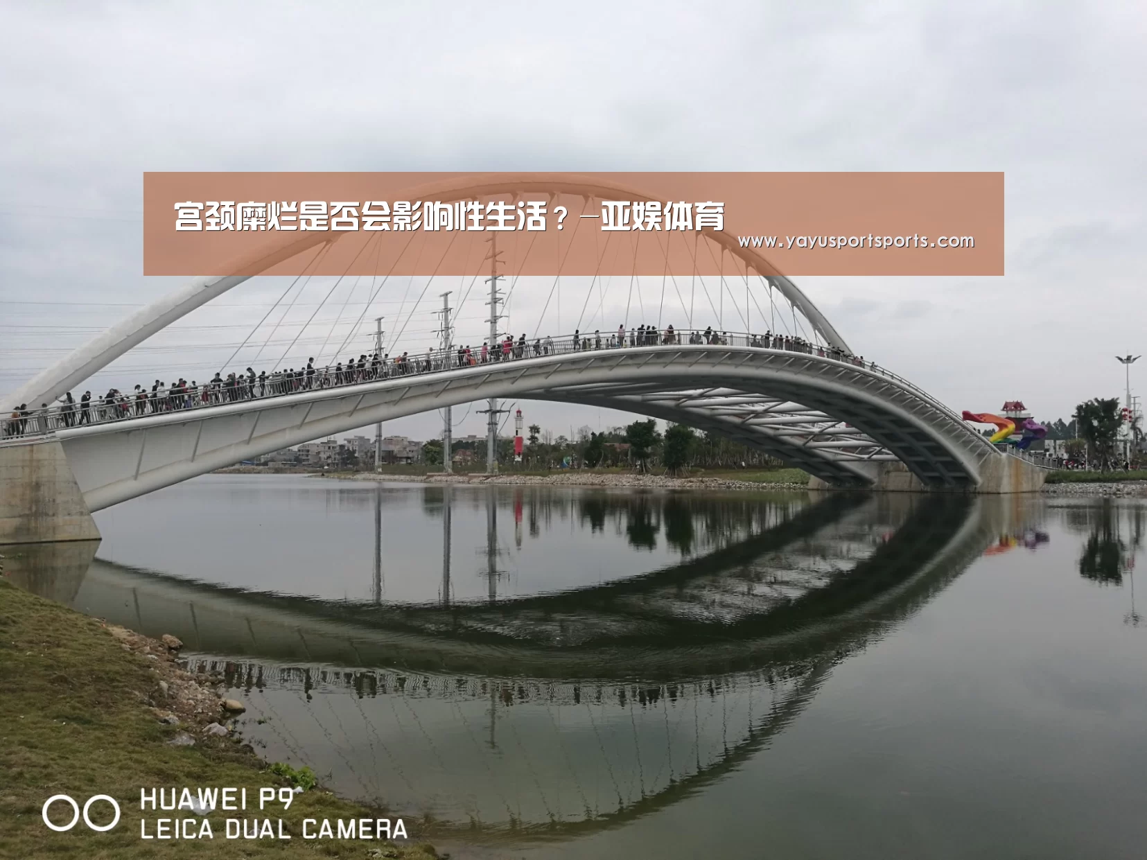 宫颈糜烂是否会影响性生活?-亚娱体育(图3) 亚娱体育下载app